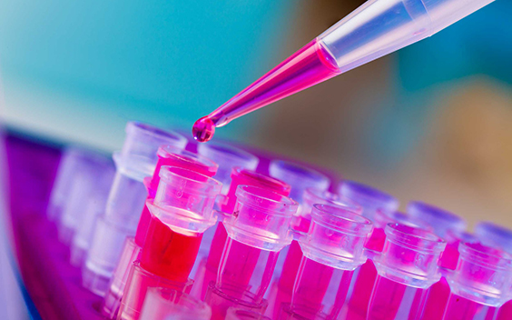 PCR strip test tubes and micropipette in genetics laboratory